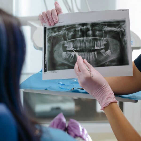 placa dental